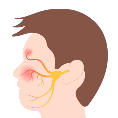 Gesichtsneuralgie